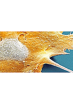 Watch Full Movie On DNA Mutation - Watch Trailer